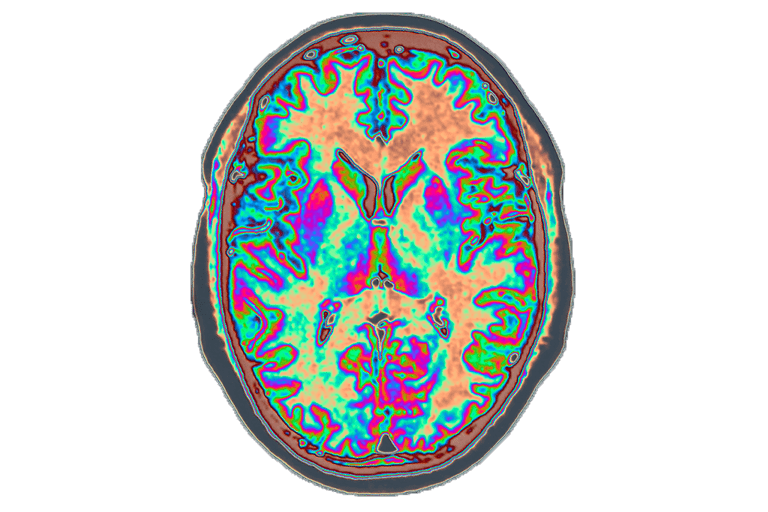 cerveau humain